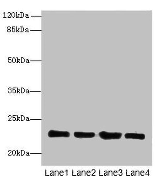 HPCAL4 Antibody in Western Blot (WB)