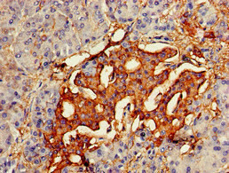 VAV3 Antibody in Immunohistochemistry (Paraffin) (IHC (P))