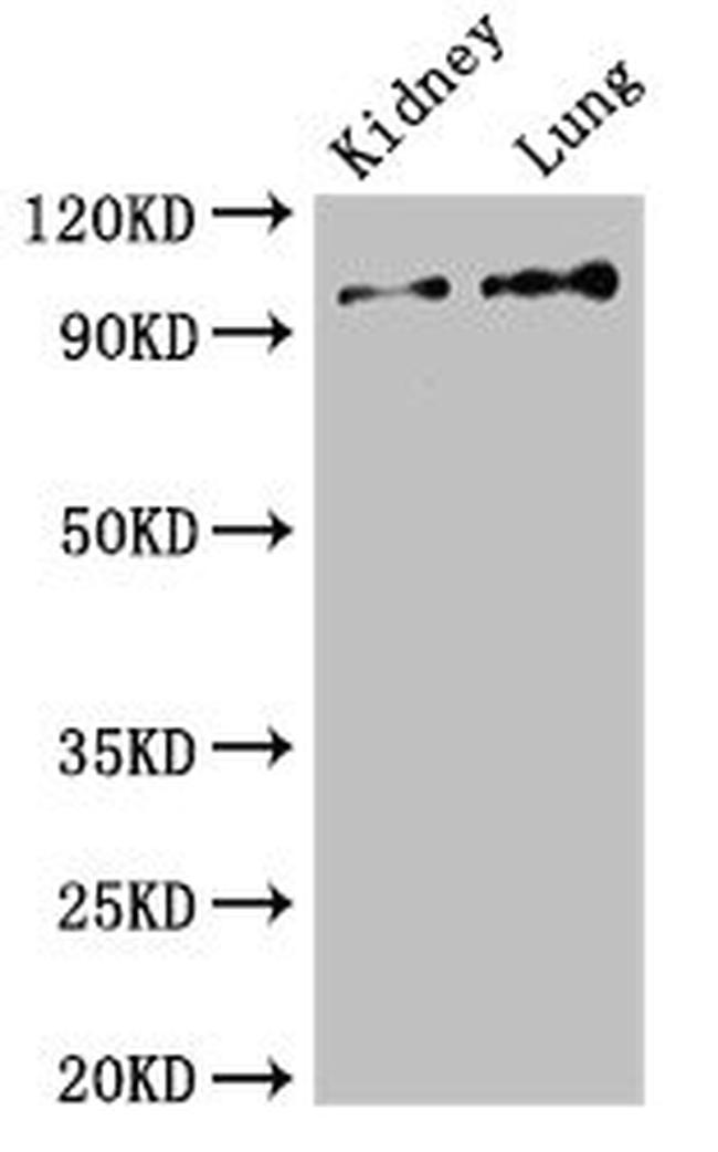 VAV3 Antibody in Western Blot (WB)