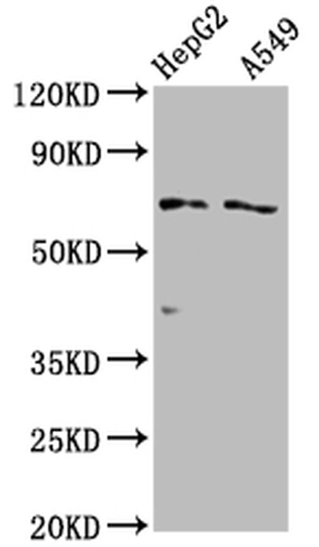 OATP2 Antibody in Western Blot (WB)