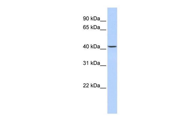 JMJD5 Antibody in Western Blot (WB)