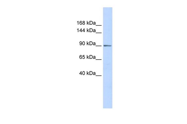 PHF16 Antibody in Western Blot (WB)