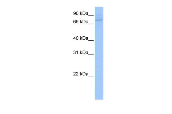 ZNF440 Antibody in Western Blot (WB)