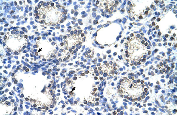 TR2 Antibody in Immunohistochemistry (IHC)