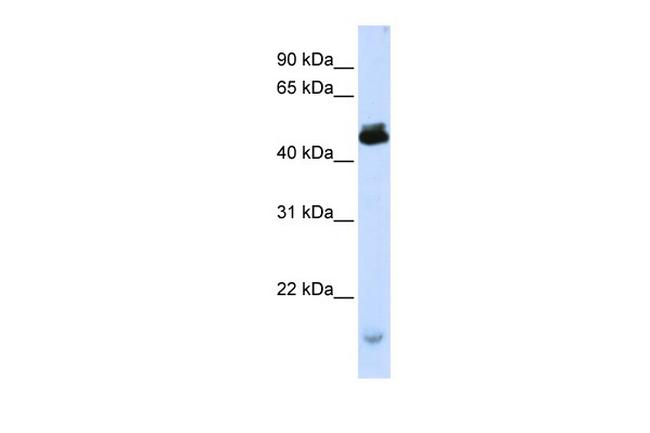 KCMF1 Antibody in Western Blot (WB)