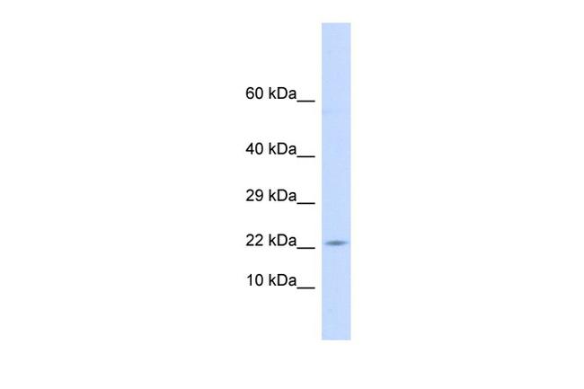 CRF Antibody in Western Blot (WB)