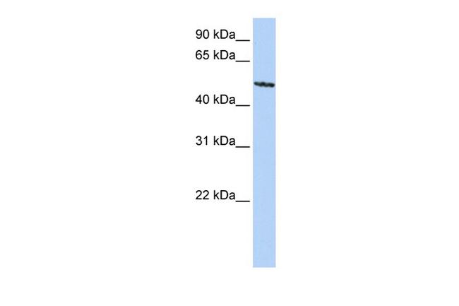 SIGLEC6 Antibody in Western Blot (WB)