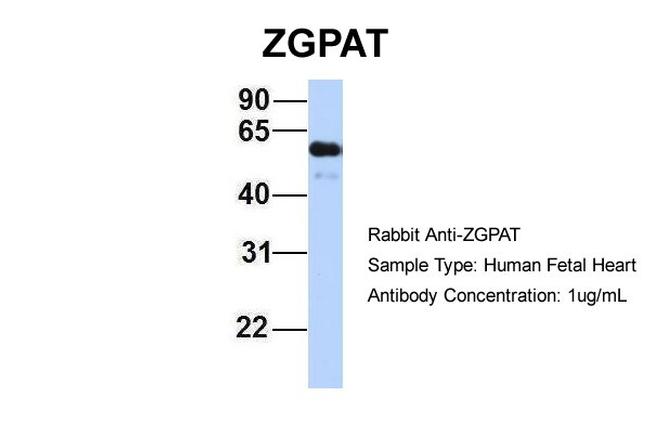 ZGPAT Antibody in Western Blot (WB)