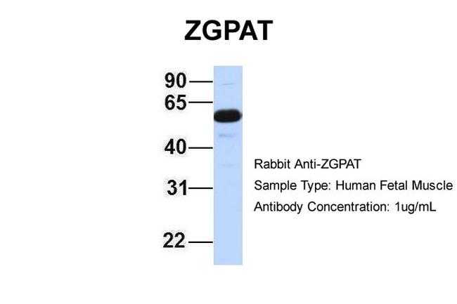 ZGPAT Antibody in Western Blot (WB)