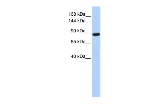 HACE1 Antibody in Western Blot (WB)