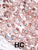 BAK Antibody in Immunohistochemistry (Paraffin) (IHC (P))