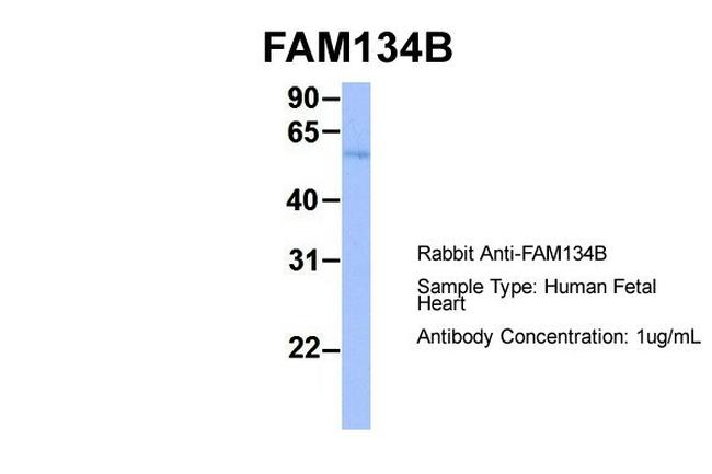 FAM134B Antibody in Western Blot (WB)