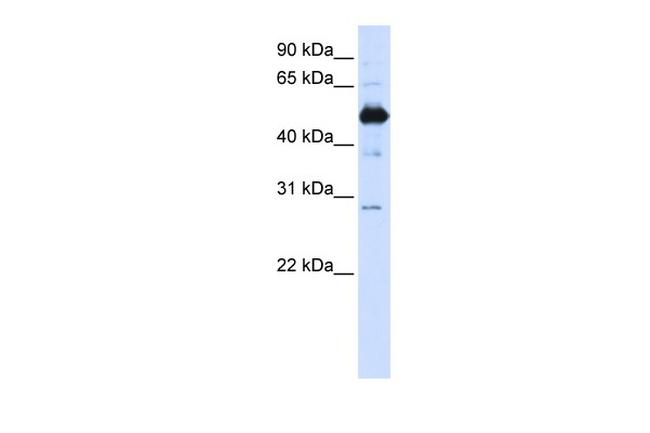 FAM134B Antibody in Western Blot (WB)