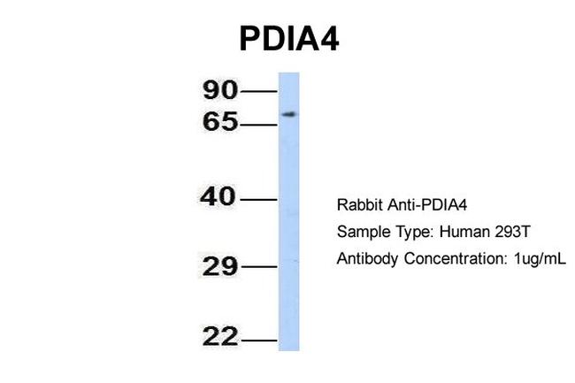 ERP72 Antibody in Western Blot (WB)