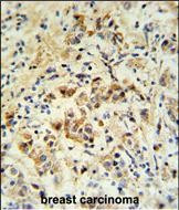 BID Antibody in Immunohistochemistry (Paraffin) (IHC (P))