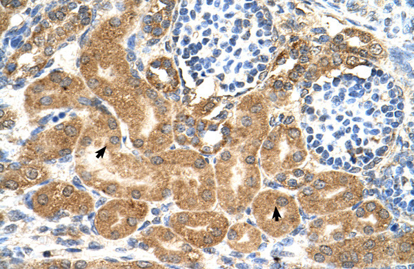 TMEM69 Antibody in Immunohistochemistry (IHC)