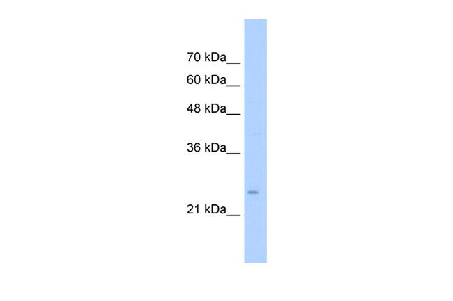 TMEM69 Antibody in Western Blot (WB)