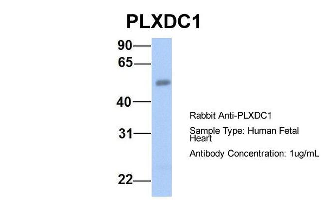 TEM7 Antibody in Western Blot (WB)