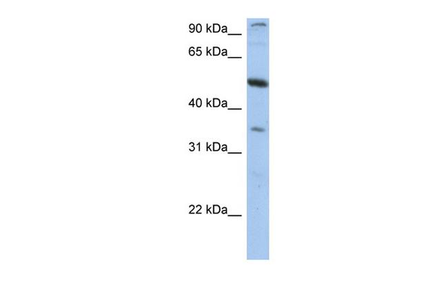 TEM7 Antibody in Western Blot (WB)