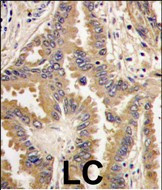 BAD Antibody in Immunohistochemistry (Paraffin) (IHC (P))