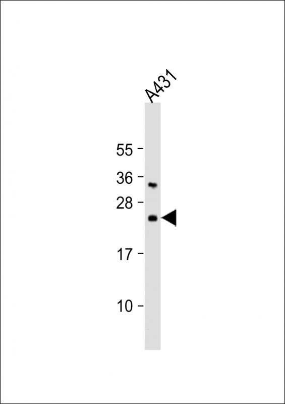 BAD Antibody in Western Blot (WB)