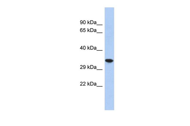 CREG2 Antibody in Western Blot (WB)