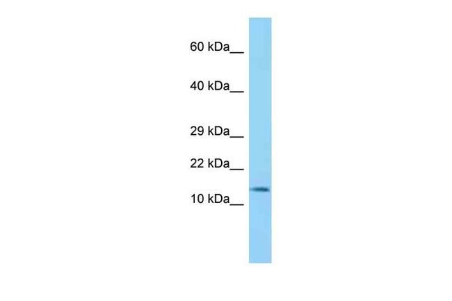 BLOC1S2 Antibody in Western Blot (WB)