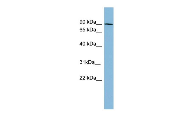 PKC beta-1 Antibody in Western Blot (WB)