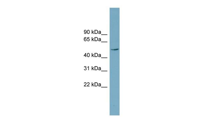 LANCL2 Antibody in Western Blot (WB)