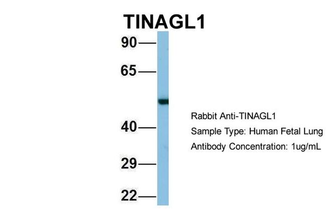 TINAGL1 Antibody in Western Blot (WB)