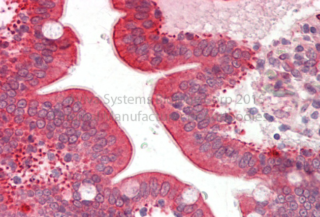 CYP3A5 Antibody in Immunohistochemistry (Paraffin) (IHC (P))