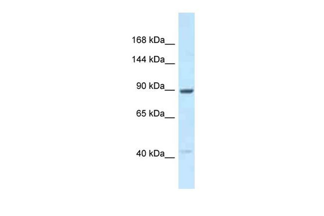 UNC45B Antibody in Western Blot (WB)