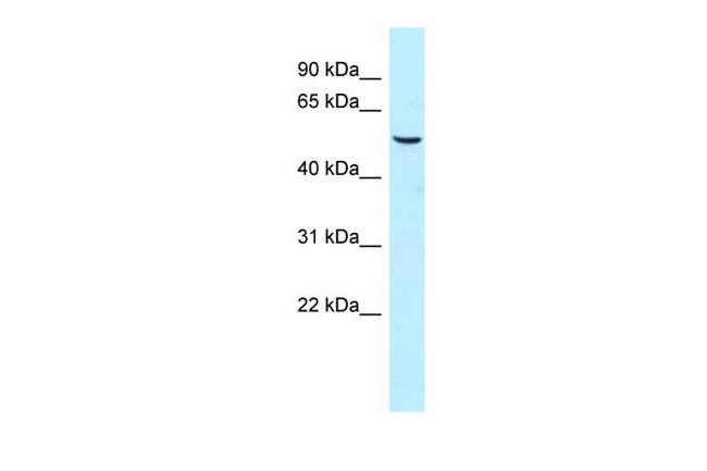 SNX8 Antibody in Western Blot (WB)