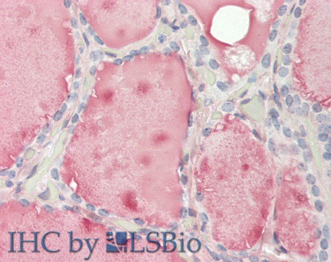 FCGR2B Antibody in Immunohistochemistry (Paraffin) (IHC (P))