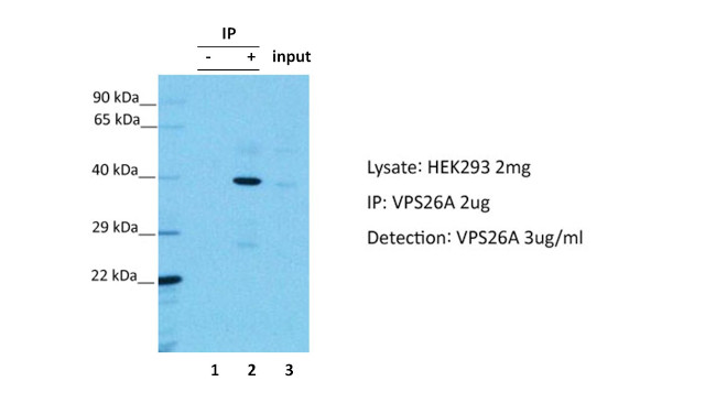 VPS26A Antibody in Immunoprecipitation (IP)