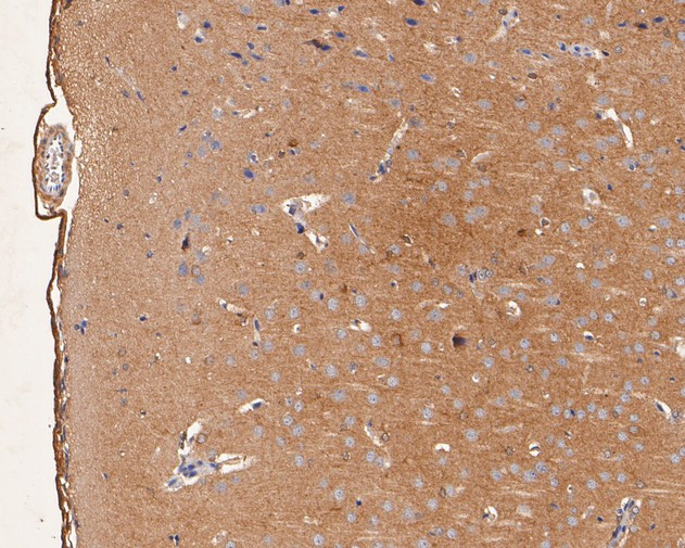 GABRA1 Antibody in Immunohistochemistry (Paraffin) (IHC (P))