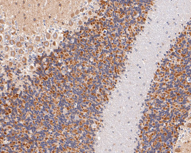 GABRA1 Antibody in Immunohistochemistry (Paraffin) (IHC (P))