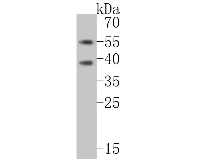 CHRNA1 Antibody in Western Blot (WB)