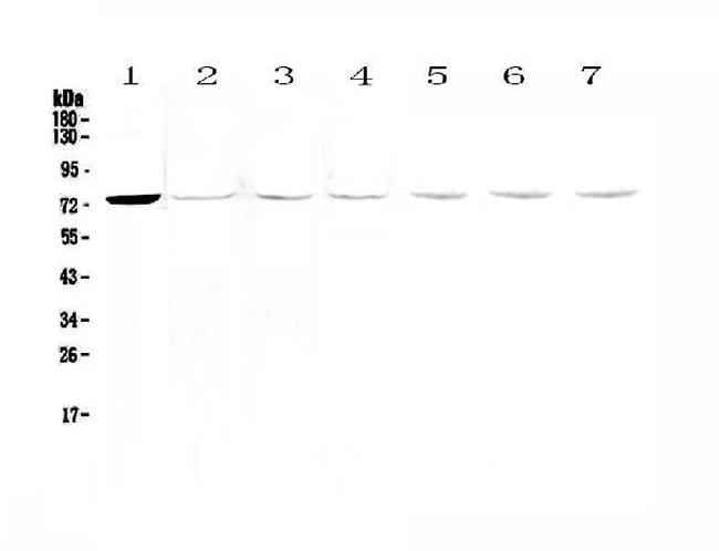 Tec Antibody in Western Blot (WB)