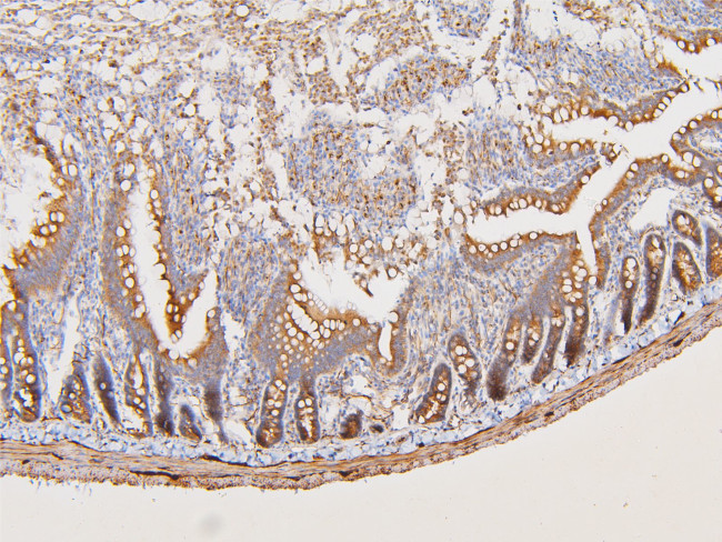 ATP5G1/2/3 Antibody in Immunohistochemistry (Paraffin) (IHC (P))