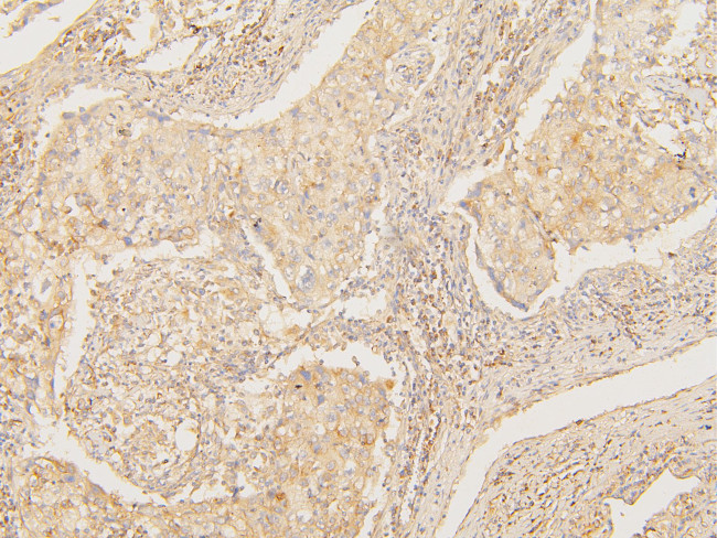 ATP5G1/2/3 Antibody in Immunohistochemistry (Paraffin) (IHC (P))