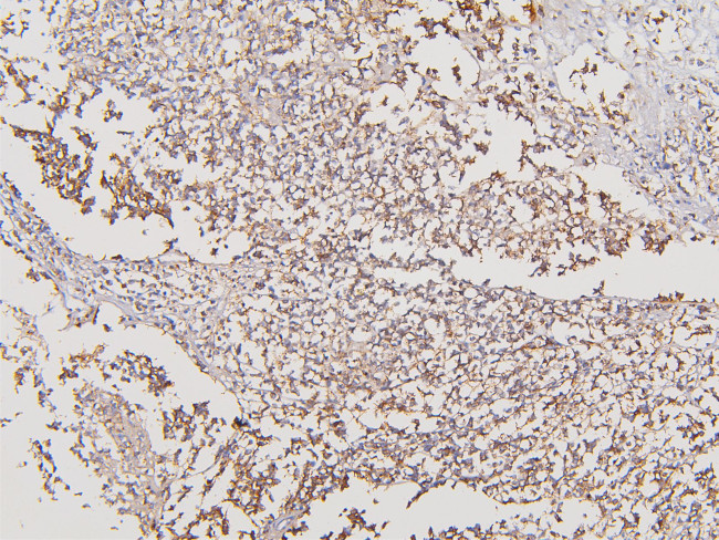 ATP5G1/2/3 Antibody in Immunohistochemistry (Paraffin) (IHC (P))