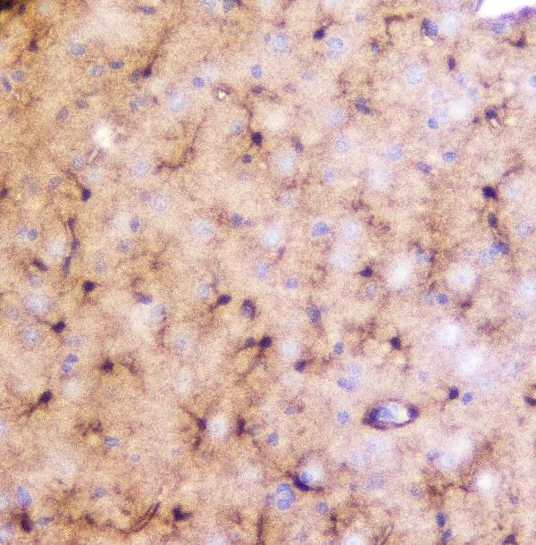 LRTOMT Antibody in Immunohistochemistry (Paraffin) (IHC (P))