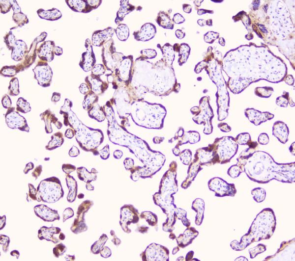 LRTOMT Antibody in Immunohistochemistry (Paraffin) (IHC (P))