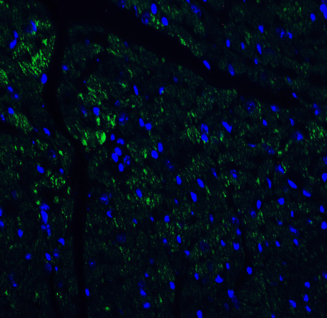 IL-17A Antibody in Immunohistochemistry (Paraffin) (IHC (P))