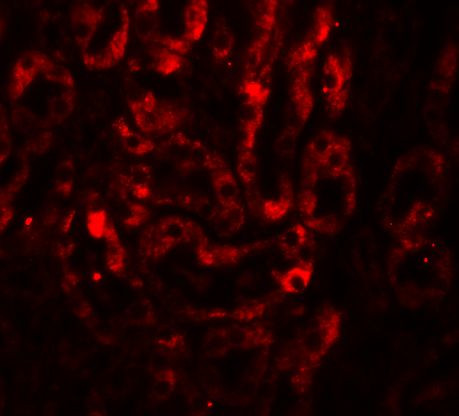 IL-17A Antibody in Immunohistochemistry (Paraffin) (IHC (P))