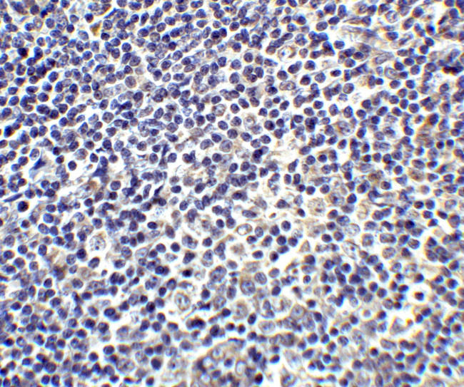 IL-17A Antibody in Immunohistochemistry (Paraffin) (IHC (P))