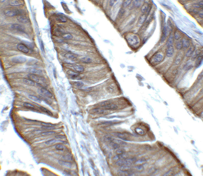 TET2 Antibody in Immunohistochemistry (Paraffin) (IHC (P))