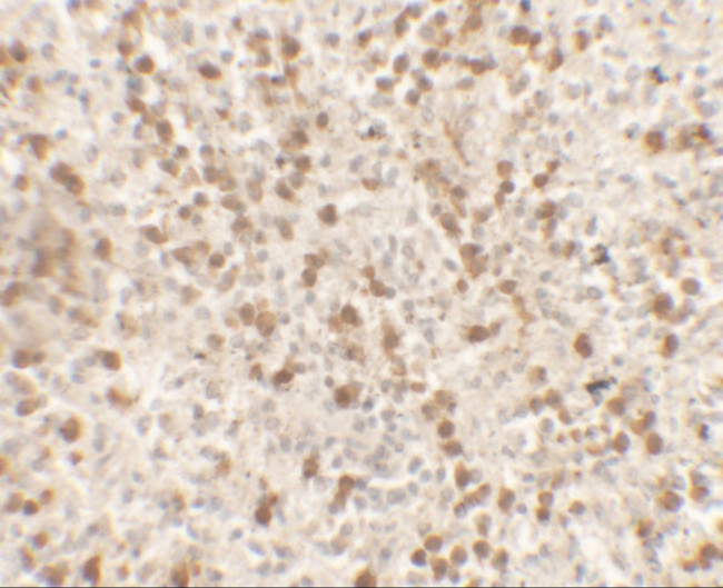 IL-9 Antibody in Immunohistochemistry (Paraffin) (IHC (P))