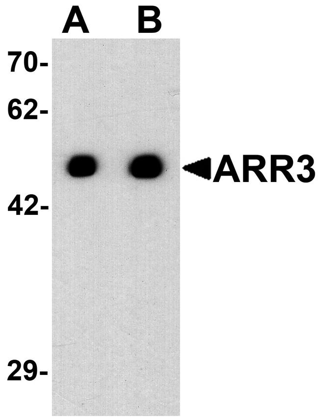 ARR3 Antibody in Western Blot (WB)